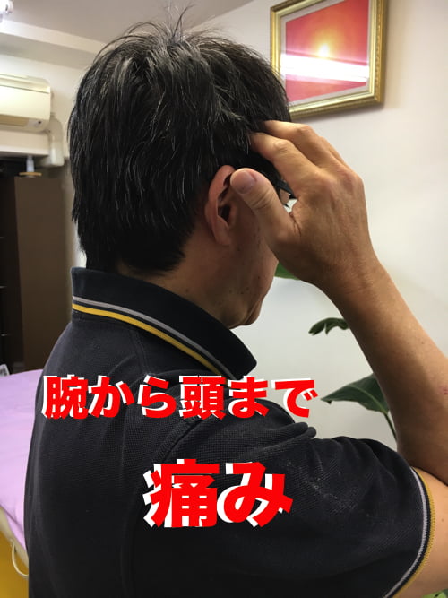 広島で偏頭痛の治療_肩から首と頭が痛い_薬を使わず治すヘッドマッサージ_ドライヘッドスパ