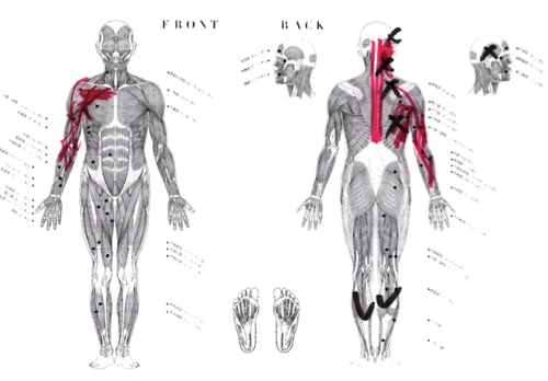 広島で偏頭痛の治療_肩から首と頭が痛い_薬を使わず治すヘッドマッサージ_ドライヘッドスパ