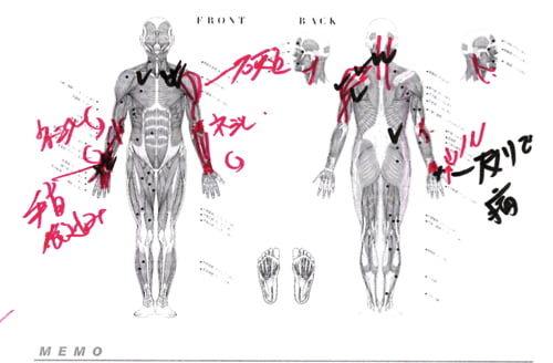 治らない四十肩の原因と治療方法-広島で四十肩を治す専門技術の整体院
