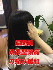 広島_偏頭痛や緊張型頭痛の痛み治療のヘッドマッサージ1