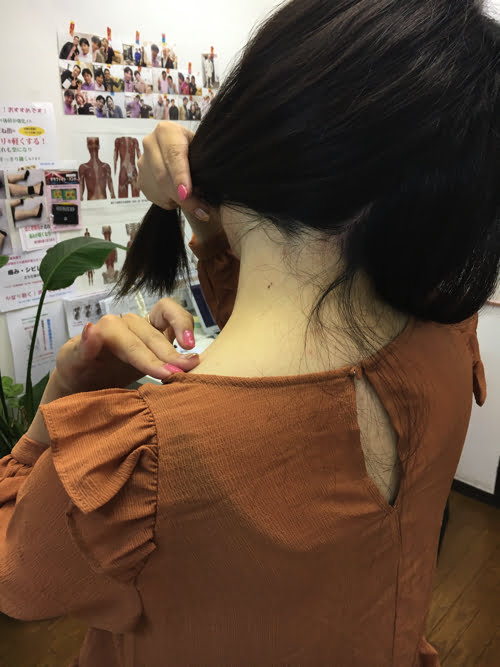 広島_偏頭痛や緊張型頭痛の痛み治療のヘッドマッサージ10