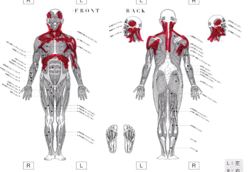 広島_偏頭痛や緊張型頭痛の痛み治療のヘッドマッサージ11