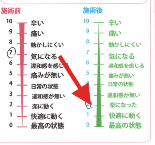 広島_偏頭痛や緊張型頭痛の痛み治療のヘッドマッサージ12