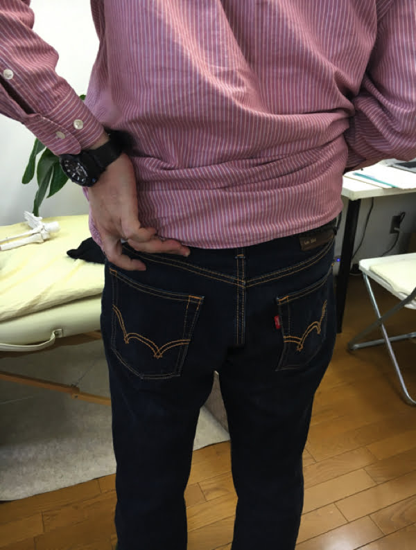 歩くと痛みが増す腰部脊柱管狭窄症と間欠性跛行の原因と治療方法の実例3