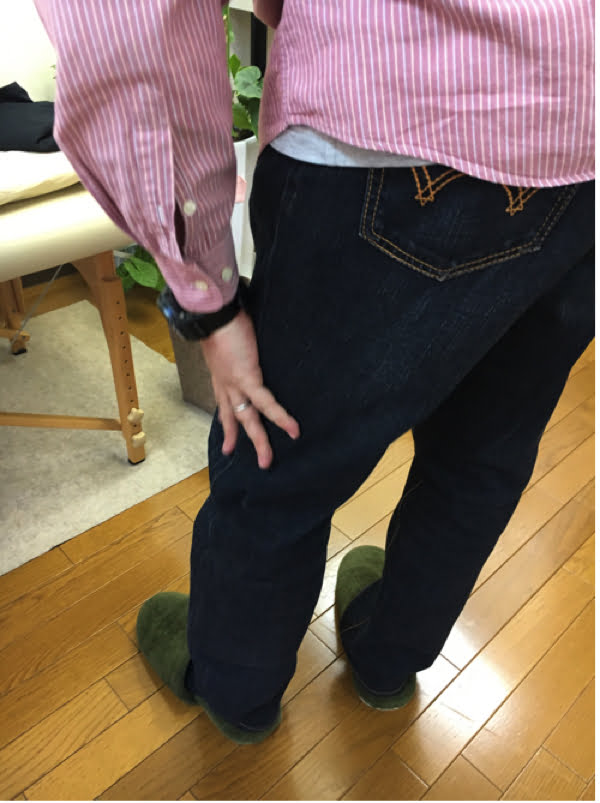 歩くと痛みが増す腰部脊柱管狭窄症と間欠性跛行の原因と治療方法の実例4