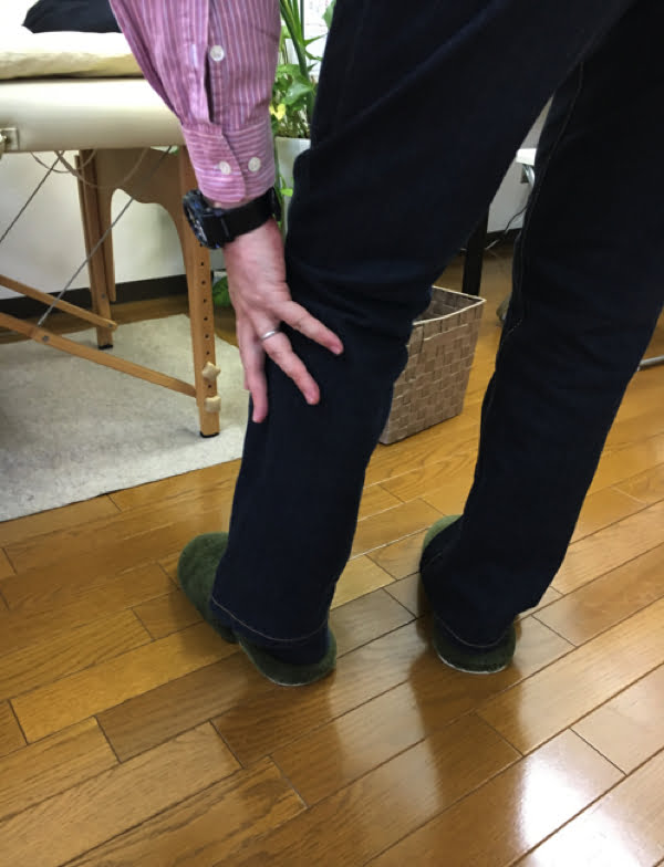 歩くと痛みが増す腰部脊柱管狭窄症と間欠性跛行の原因と治療方法の実例5