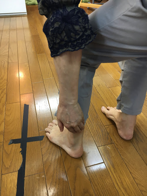 腰痛-すべり症-坐骨神経痛の治療で痛みが消えた実例2