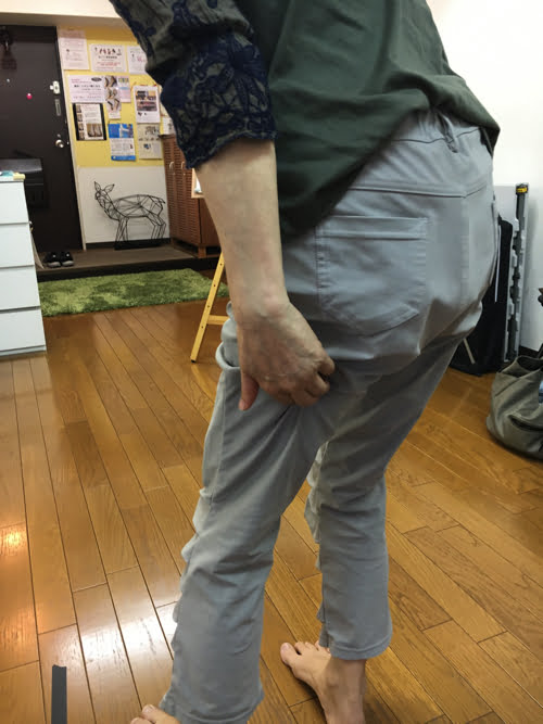 腰痛-すべり症-坐骨神経痛の治療で痛みが消えた実例4