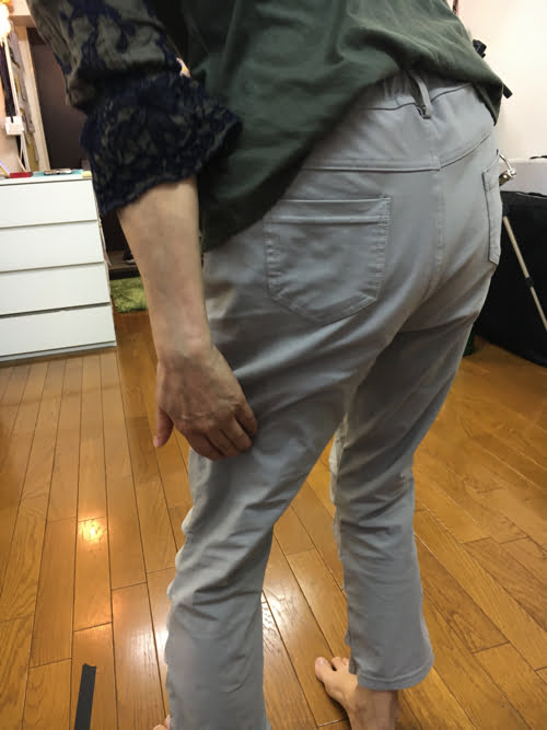 腰痛-すべり症-坐骨神経痛の治療で痛みが消えた実例5