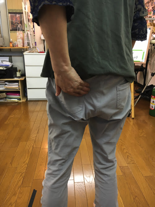 腰痛-すべり症-坐骨神経痛の治療で痛みが消えた実例7