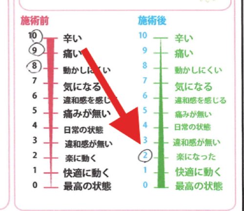 五十肩治療_首の痛み肩の痛みで眠れない症状の治し方18