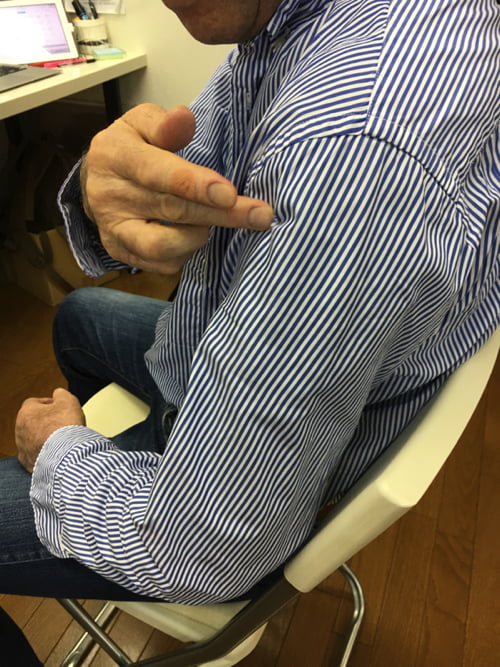 五十肩治療_首の痛み肩の痛みで眠れない症状の治し方5