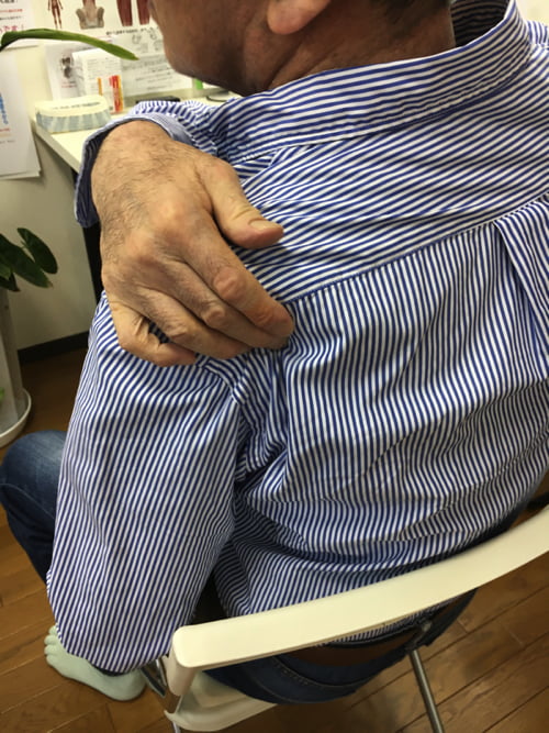 五十肩治療_首の痛み肩の痛みで眠れない症状の治し方6