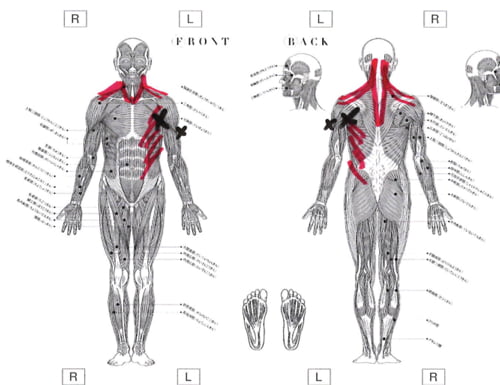 五十肩治療_首の痛み肩の痛みで眠れない症状の治し方8