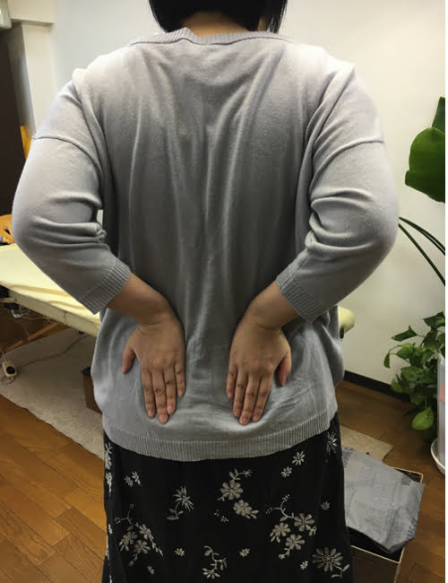 AKA博田法効果なし-慢性腰痛-長く続くぎっくり腰-原因と治療方法4