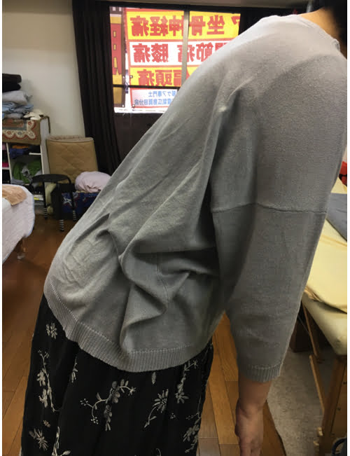 AKA博田法効果なし-慢性腰痛-長く続くぎっくり腰-原因と治療方法5