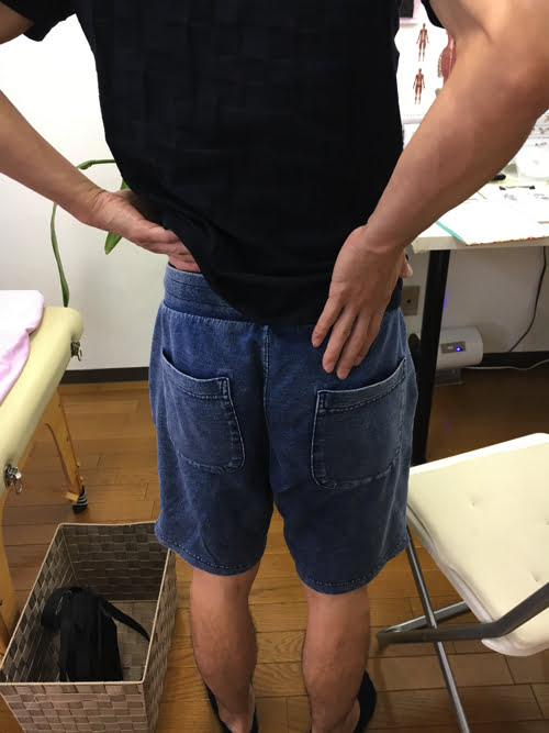 広島_神経ブロック注射が効かないヘルニアの治療4