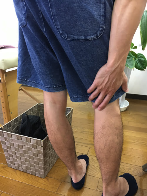 広島_神経ブロック注射が効かないヘルニアの治療5