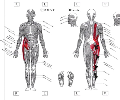 広島_神経ブロック注射が効かないヘルニアの治療7