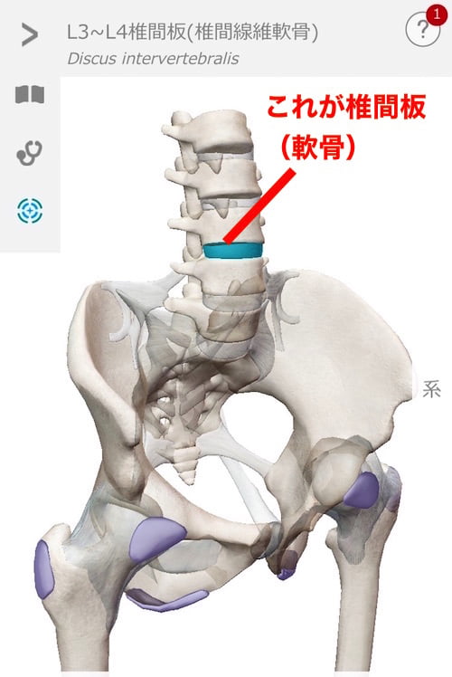 広島_神経ブロック注射が効かないヘルニアの治療8