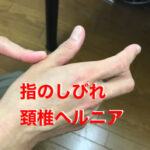 頚椎ヘルニアで指の痺れ原因と治療方法13