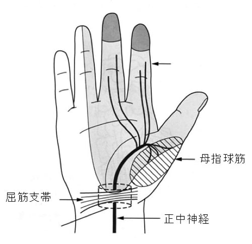 頚椎ヘルニアで指の痺れ原因と治療方法2