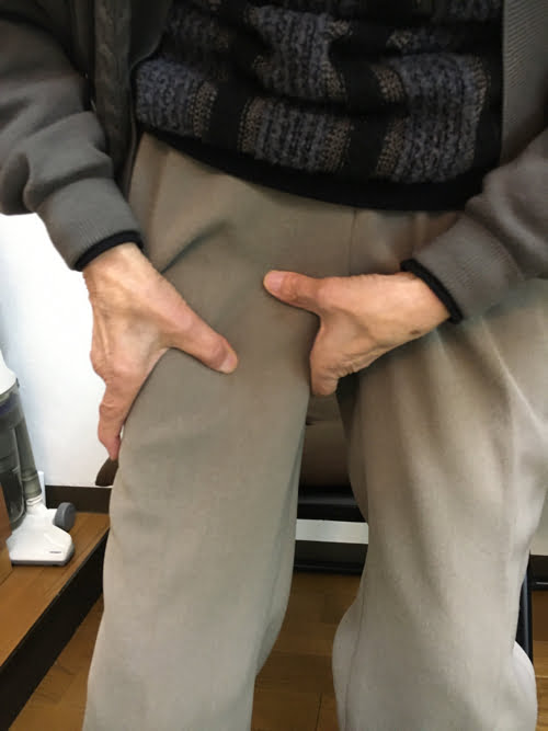 転んだ後足の付根が痛くて歩けなくなったお客様の改善例12