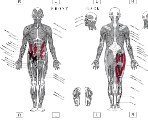 転んだ後足の付根が痛くて歩けなくなったお客様の改善例4