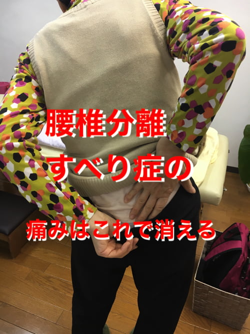 脊椎分離すべり症の腰の痛みの原因と治療方法1