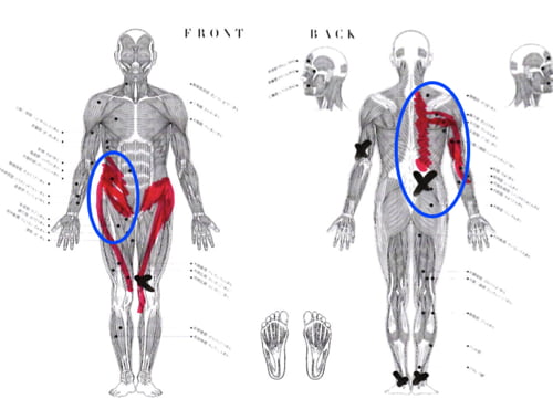 脊椎分離すべり症の腰の痛みの原因と治療方法15