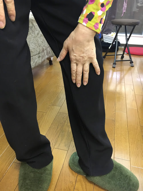 脊椎分離すべり症の腰の痛みの原因と治療方法3