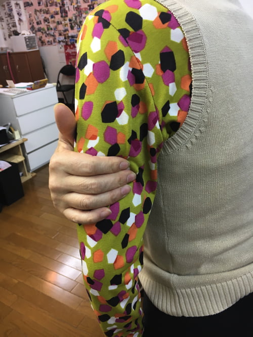 脊椎分離すべり症の腰の痛みの原因と治療方法5