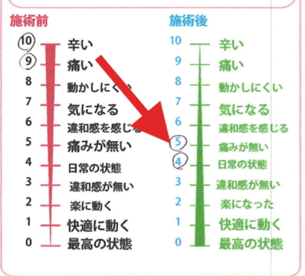 膝の痛みの治療_ヒアルロン酸注射が効かない場合の原因と治療法14