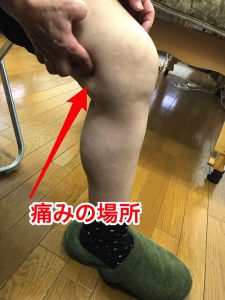 膝の痛み治療_膝の内側の痛み