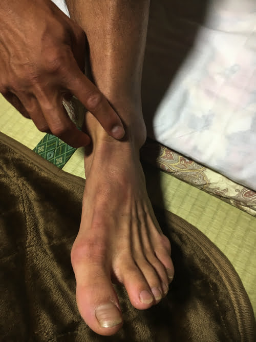 NHK_BS2-グレートトラバース田中陽希_日本3百名山ひと筆書き_足の故障と腰・肩の調整