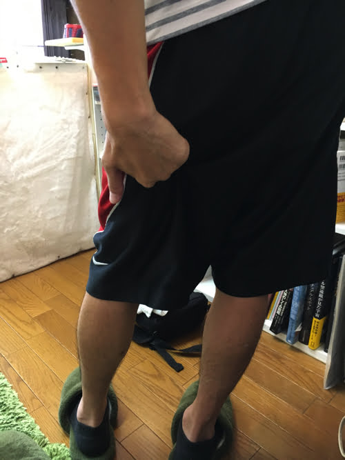 ぎっくり腰_ヘルニアが再発する理由と治療方法