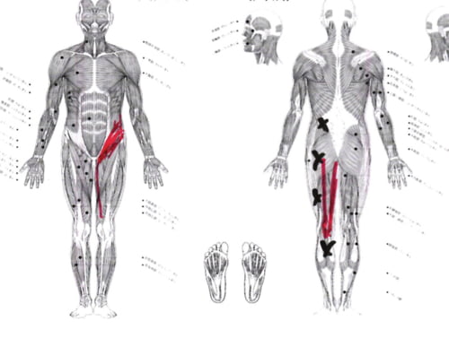 ぎっくり腰_ヘルニアが再発する理由と治療方法