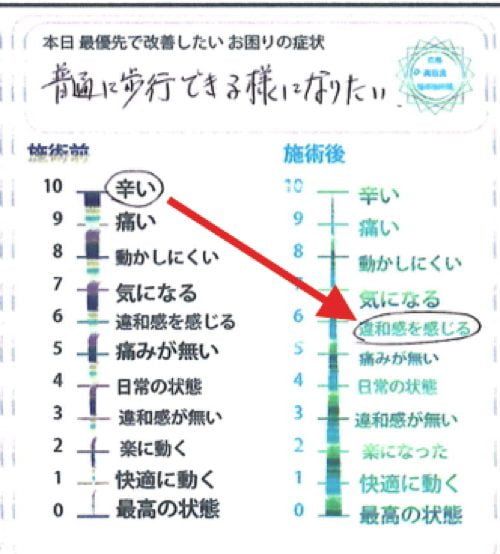 くしゃみで「ぎっくり腰」になった際の治療-広島で腰痛-ぎっくり腰の治療で有名な整体広島眞田流の実例11