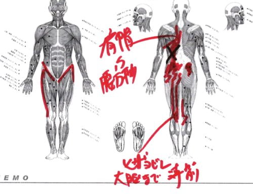くしゃみで「ぎっくり腰」になった際の治療-広島で腰痛-ぎっくり腰の治療で有名な整体広島眞田流の実例8
