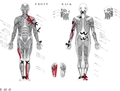 ヘルニアと坐骨神経痛の腰の痛みと足の痺れ_足に力が入らない原因と治療方法_広島_腰痛ヘルニア治療で有名な整体院