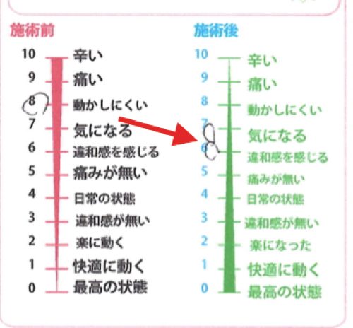 ヘルニアと坐骨神経痛の腰の痛みと足の痺れ_足に力が入らない原因と治療方法_広島_腰痛ヘルニア治療で有名な整体院