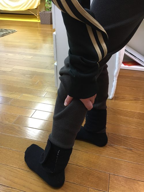 ヘルニアは誤診か-ヘルニア手術失敗か-ヘルニア手術で歩けなくなった女性の回復施術6