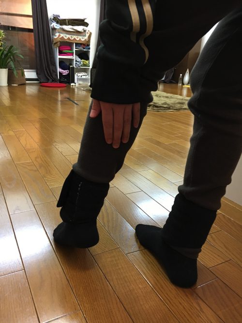 ヘルニアは誤診か-ヘルニア手術失敗か-ヘルニア手術で歩けなくなった女性の回復施術7