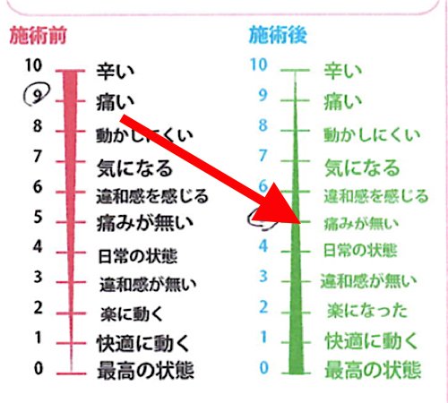 リハビリで再発した腰痛の原因と治療方法
