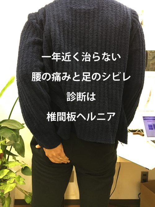 一年近く治らなかった椎間板ヘルニアの治療-広島で椎間板ヘルニアの治療なら整体広島眞田流-治った例1