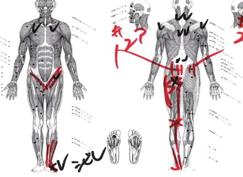 一年近く治らなかった椎間板ヘルニアの治療-広島で椎間板ヘルニアの治療なら整体広島眞田流-治った例5
