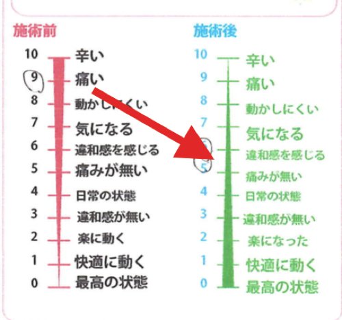 原因不明の腰の痛みの治療方法と原因解明_整形外科で注射や湿布をしても治らない例