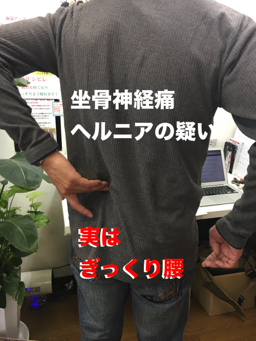 坐骨神経痛でヘルニアの疑い_腰の痛みで前かがみが出来ない症状の原因と治療方法