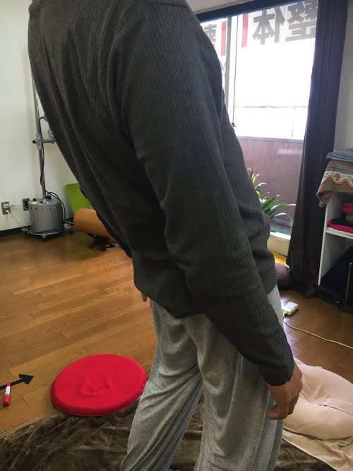 坐骨神経痛でヘルニアの疑い_腰の痛みで前かがみが出来ない症状の原因と治療方法