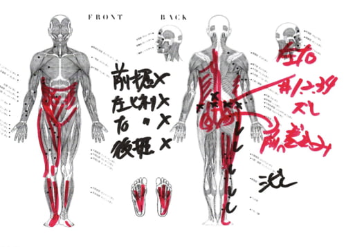 坐骨神経痛でヘルニアの疑い_腰の痛みで前かがみが出来ない症状の原因と治療方法
